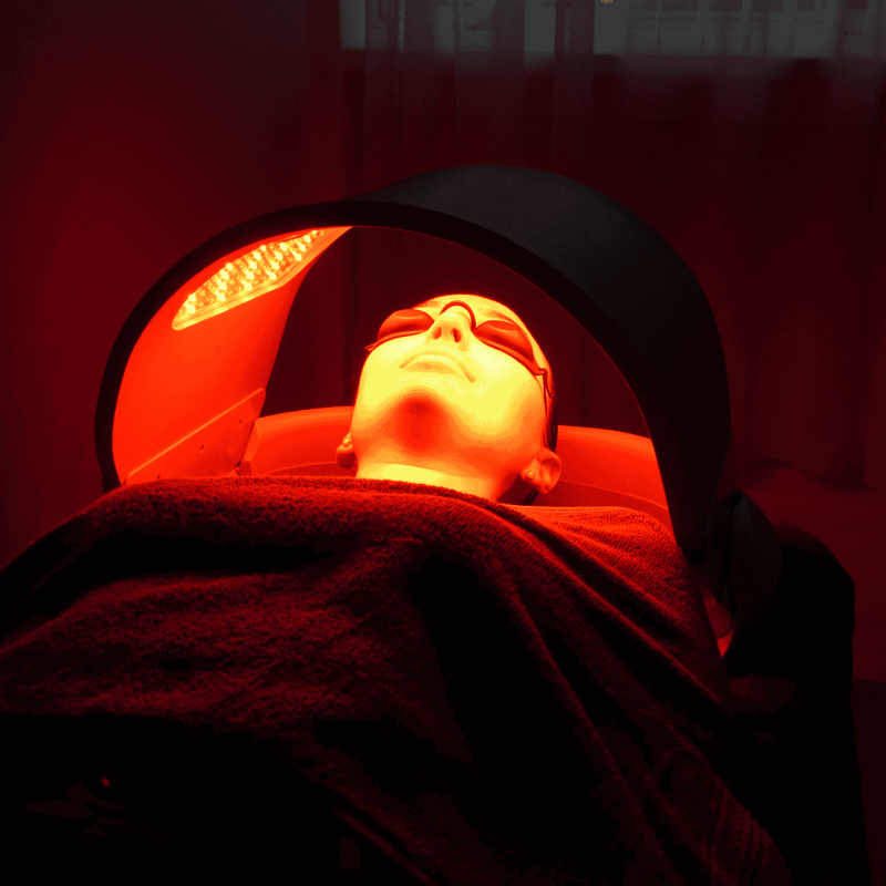 ¿Cómo tratar el acné con terapia de luz LED?