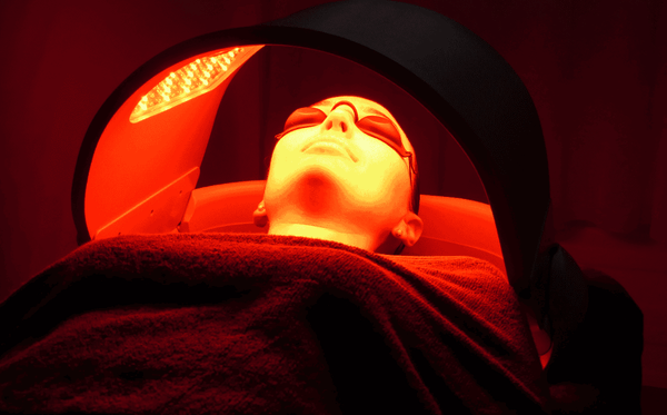 ¿Cómo tratar el acné con terapia de luz LED?