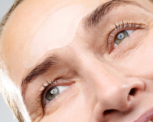 Microneedling