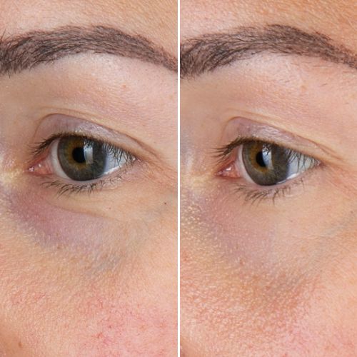 


Before &amp; After