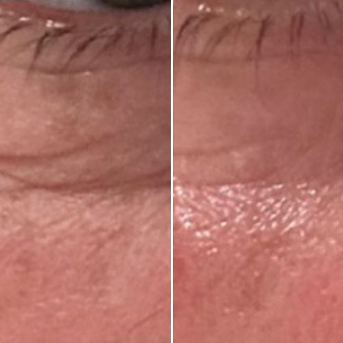 


Before &amp; After