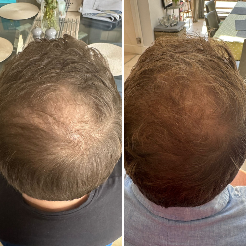 


Before &amp; After