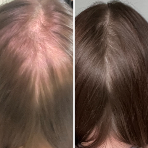 


Before &amp; After