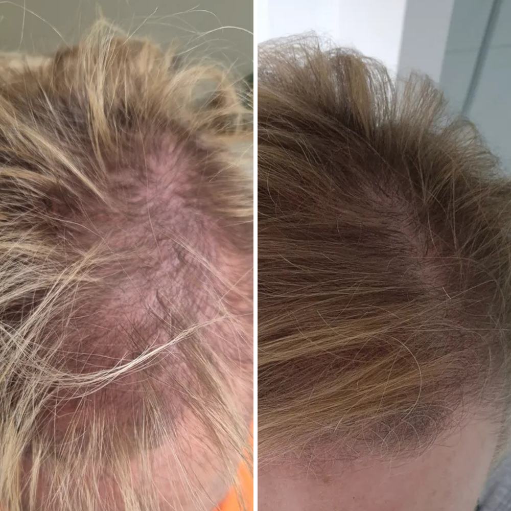 


Before &amp; After