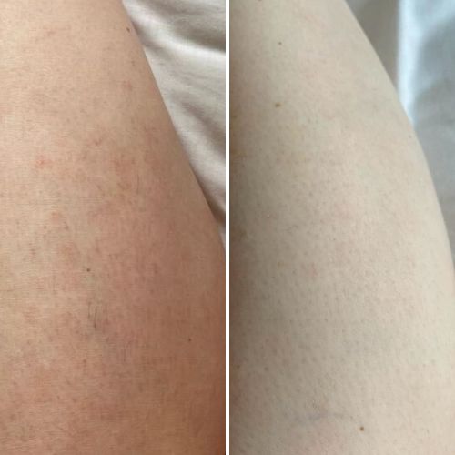 


Before &amp; After
