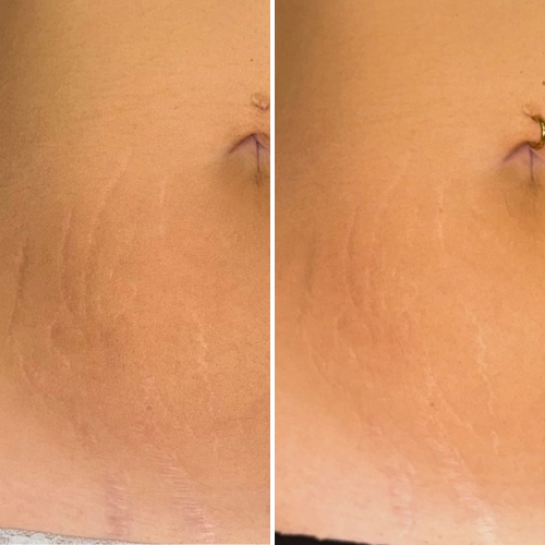 


Before &amp; After