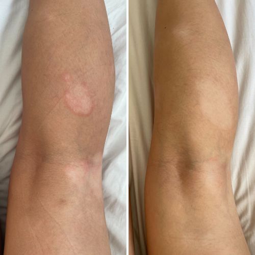 


Before &amp; After
