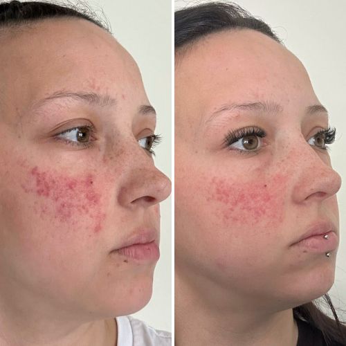Before & After