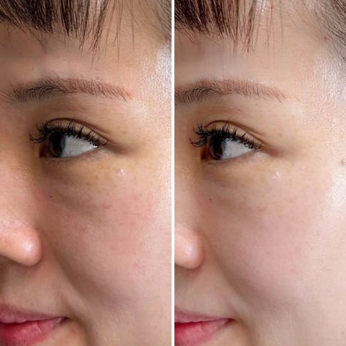 Before & After