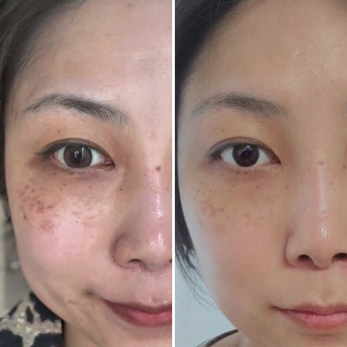 Before & After