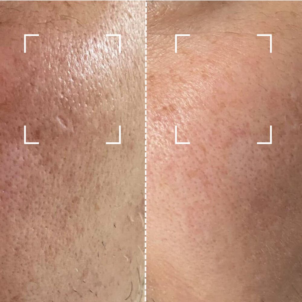 


Before &amp; After