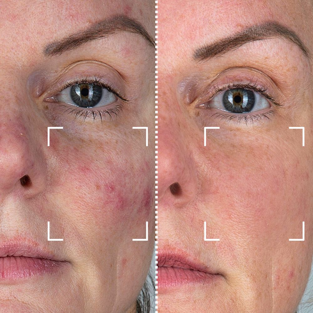 


Before &amp; After