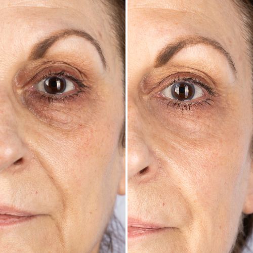 Before & After