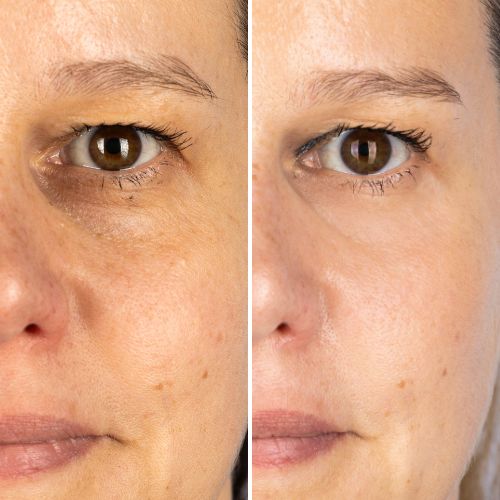 Before & After