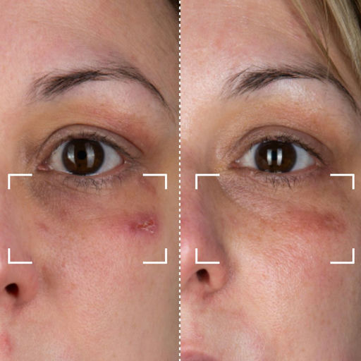 Before & After