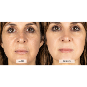 Aparato de Radiofrecuencia Facial Currentbody Skin