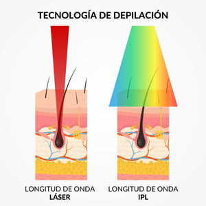 tecnología de depilación laser