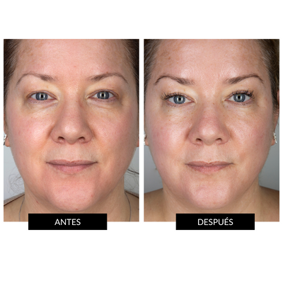 Máscara LED Facial CurrentBody Skin