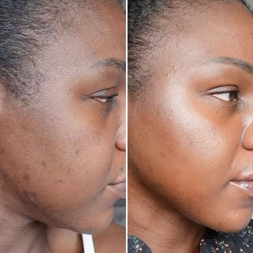 Before & After