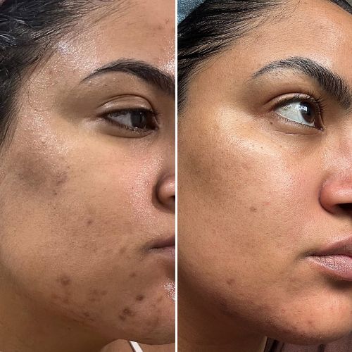 Before & After