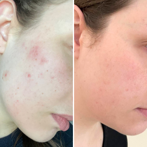 


Before &amp; After