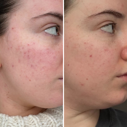 


Before &amp; After