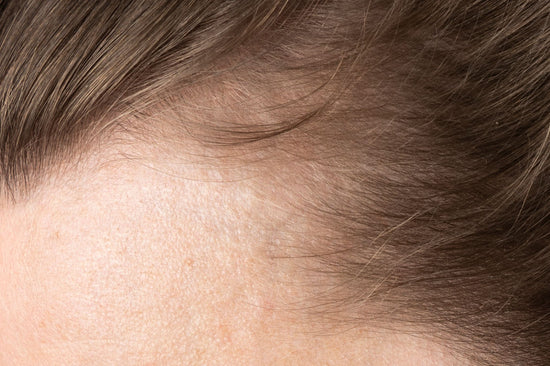 ¿Qué causa la caída de pelo en la mujer? Todo lo que necesitas saber