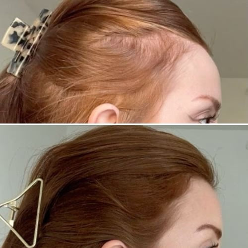 Before & After