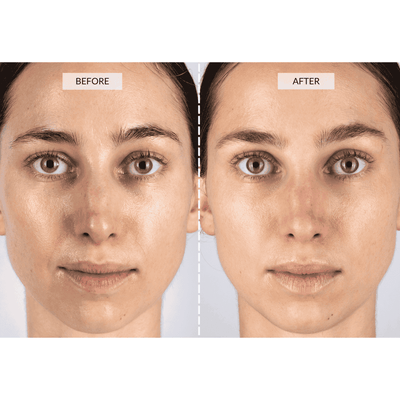 CurrentBody Skin LED 4-en-1 Máscara Mapeo zonal facial