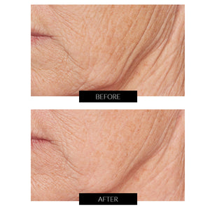 Lancer Skincare C Radiance Tratamiento Avanzado (50ml)