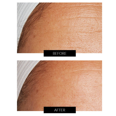Lancer Skincare The Method: Pulido para Piel Normal-Mixta (120ml)