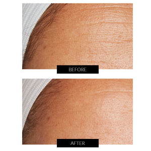 Lancer Skincare The Method: Crema Nutritiva Para Piel Normal-Mixta (50ml)