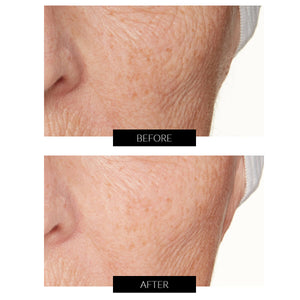 Lancer Skincare Radiance Awakening Máscara Con LES-10 (30ml)