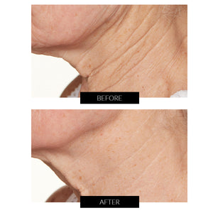 Lancer Skincare Tratamiento Intensivo con Hylaplex® y Aceite de Marula (50ml)