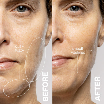 Dermaflash Luxe+ Antiedad, Exfoliación y Depilación del Vello Fino