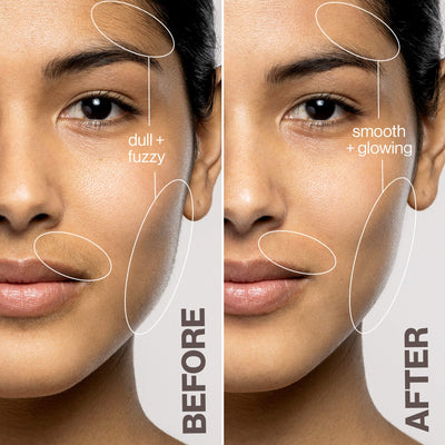 Dermaflash Luxe+ Antiedad, Exfoliación y Depilación del Vello Fino