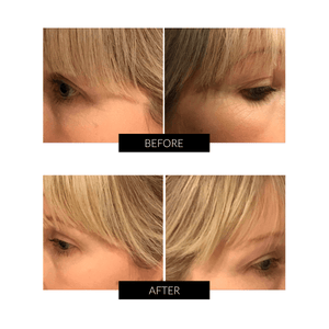 OXYjet GO Sistema facial de oxígeno