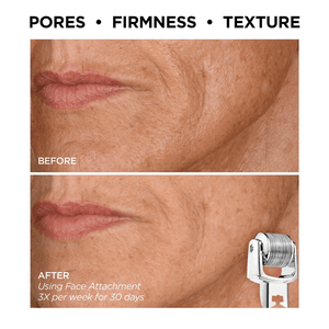 Set BeautyBio AfterGLO Corporal