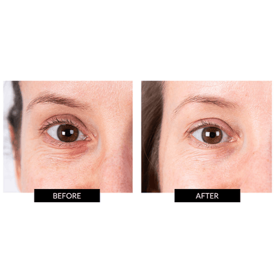 CurrentBody Skin LED Eye Perfector & 10 Eye Hydrogel Masks