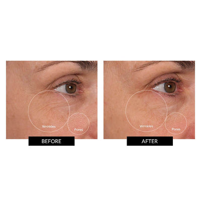 Cabezales BeautyBio Cryo Duo